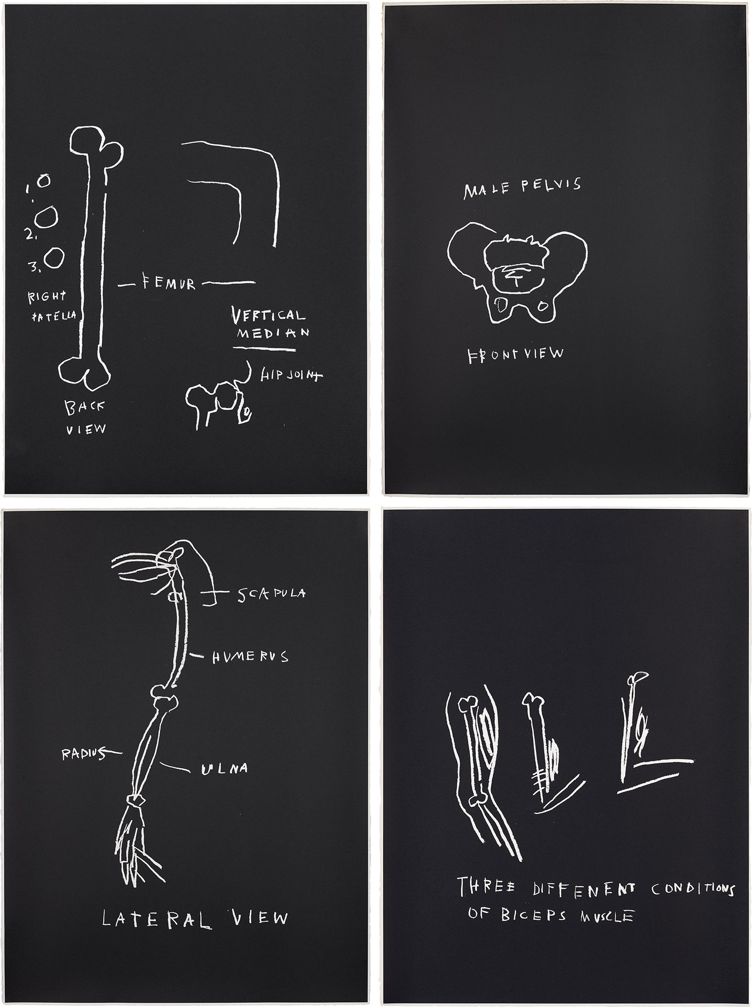 Femur, Vertical Median; Male Pelvis; Lateral View; and Three Different Conditions of Biceps Muscle, from Anatomy