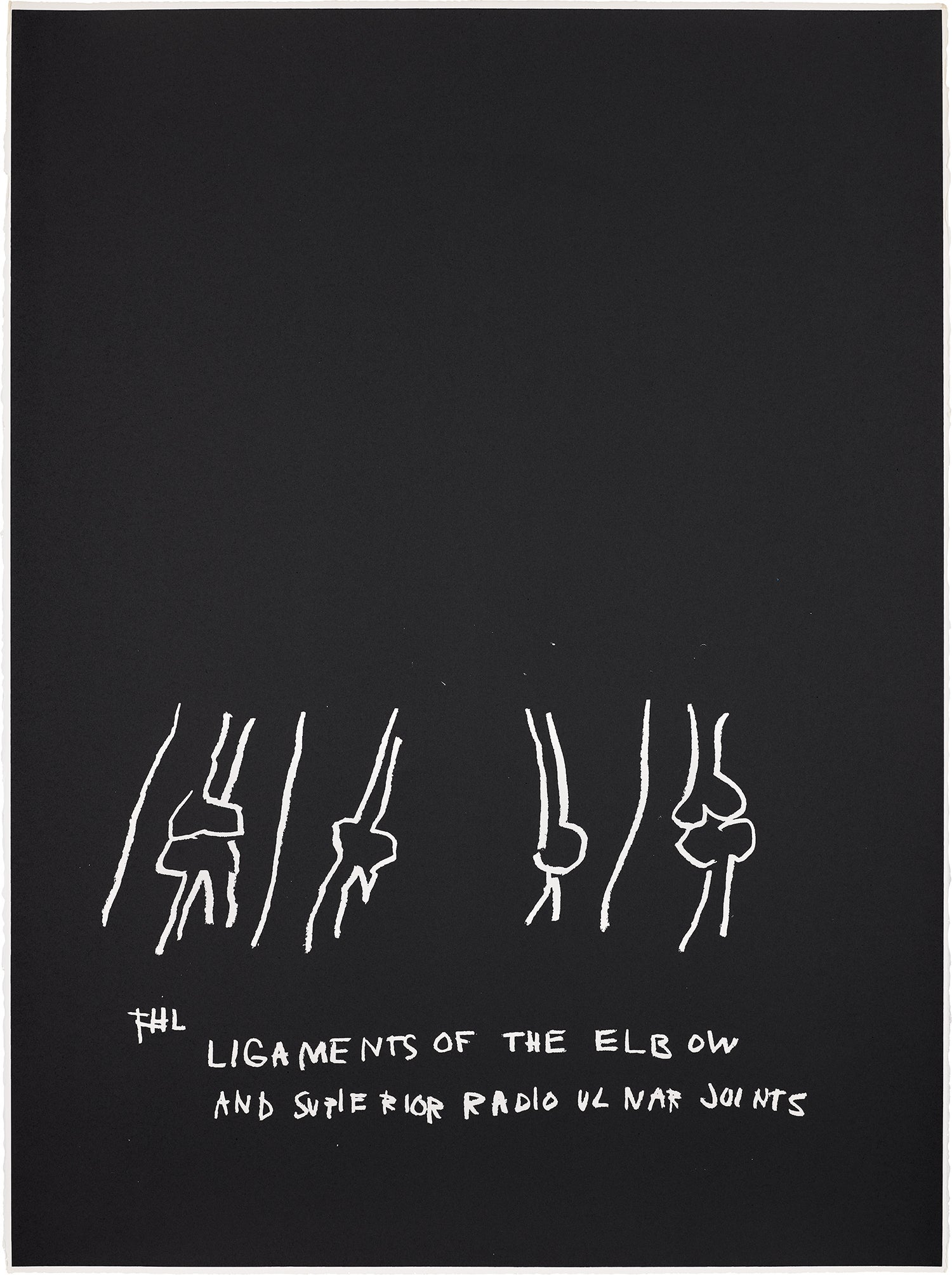 Ligaments of the Elbow, Etc., from Anatomy