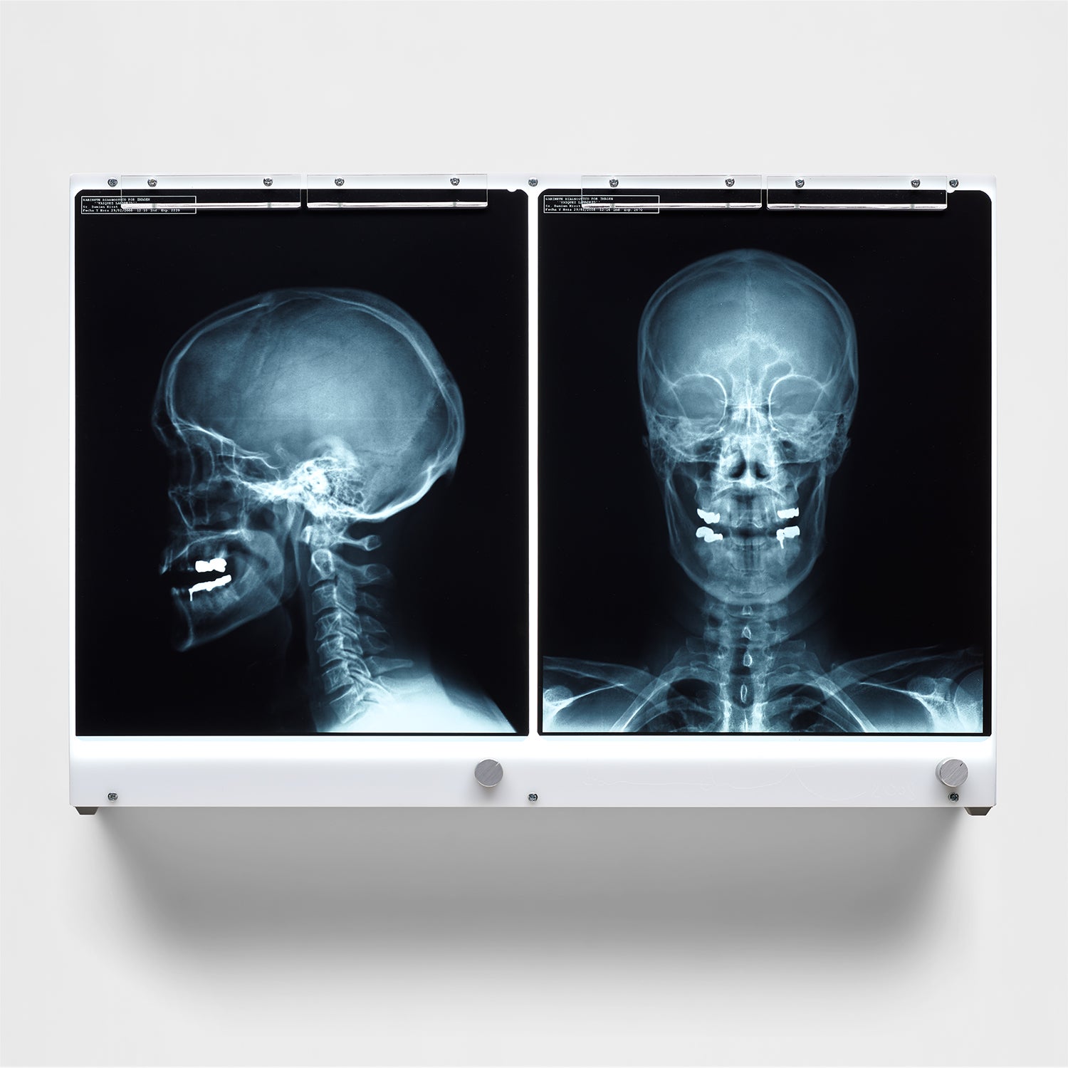 アート・デザイン・音楽 Damien Hirst Damien Hirst Damien Hirst: Online Auction