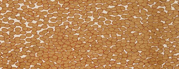 Cycles of Repetition: Kusama and Hesse